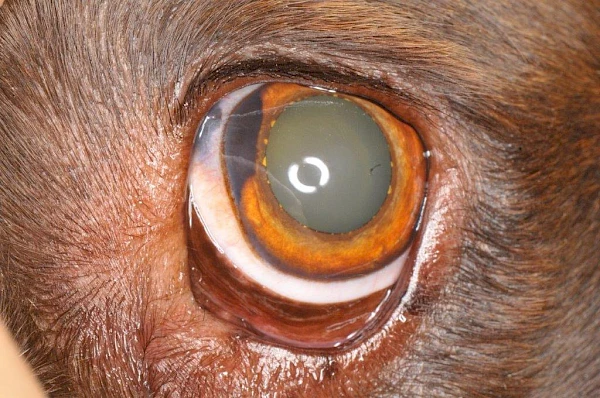 Limbales Melanom vor Operation