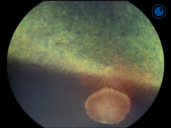 normale Netzhaut eines Pferdes