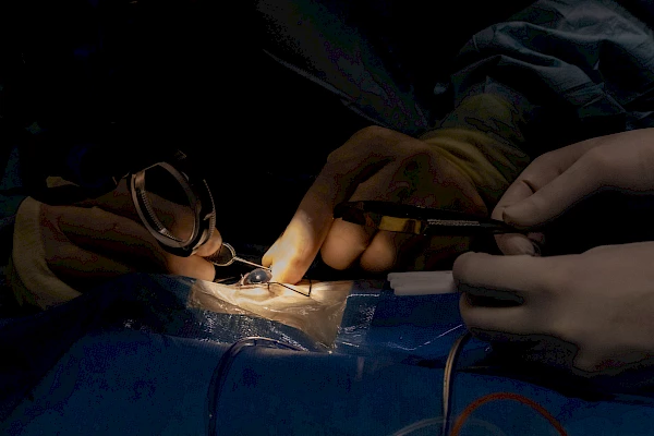 VR Vitreoretinale Operation