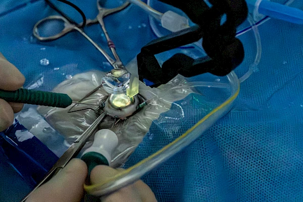 VR Vitreoretinale Operation